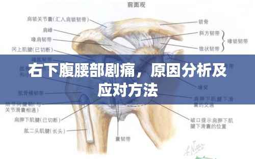 右下腹腰部剧痛，原因分析及应对方法