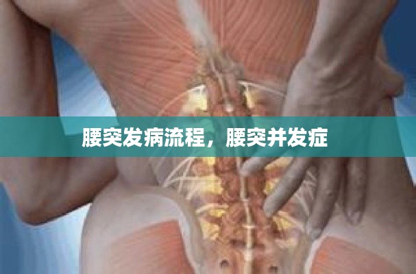 腰突发病流程,腰突并发症